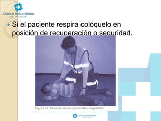 

Si el paciente respira colóquelo en
posición de recuperación o seguridad.

 