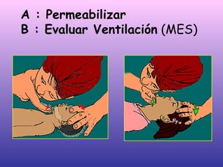 A : Permeabilizar B : Evaluar Ventilación  (MES) 