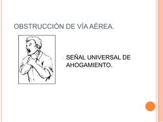 OBSTRUCCIÓN DE VÍA AÉREA.
SEÑAL UNIVERSAL DE
AHOGAMIENTO.
 