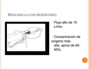 MASCARILLA CON RESERVORIO
Flujo alto de 15
L/min.
Concentración de
oxígeno más
alta, aprox de 60-
95%.
 