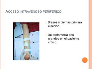 ACCESO INTRAVENOSO PERIFÉRICO
Brazos y piernas primera
elección.
De preferencia dos
grandes en el paciente
crítico.
 
