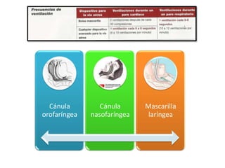 Cánula         Cánula      Mascarilla
orofaríngea   nasofaríngea    laríngea
 
