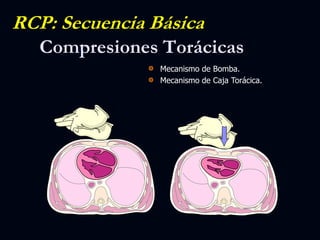 Compresiones Torácicas
Mecanismo de Bomba.
Mecanismo de Caja Torácica.
RCP: Secuencia Básica
 