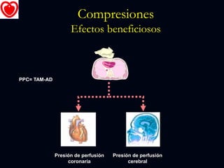 Compresiones
Efectos beneficiosos
Presión de perfusión
cerebral
Presión de perfusión
coronaria
PPC= TAM-AD
 