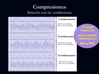 A mayor
frecuencia
mayor presión
intratorácica y
Menor PPC
Compresiones
Relación con las ventilaciones
 