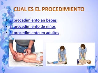 • El procedimiento en bebes
• El procedimiento de niños
• El procedimiento en adultos
 