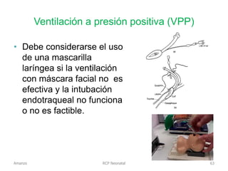 Ventilación a presión positiva (VPP)
RCP Neonatal
• Debe considerarse el uso
de una mascarilla
laríngea si la ventilación
con máscara facial no es
efectiva y la intubación
endotraqueal no funciona
o no es factible.
Amanzo 63
 