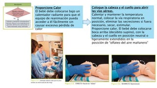 Proporcione Calor
El bebé debe colocarse bajo un
calentador radiante para que el
equipo de reanimación pueda
acceder a él fácilmente sin
causar excesiva pérdida de
calor
Coloque la cabeza y el cuello para abrir
las vías aéreas.
Calentar y mantener la temperatura
normal, colocar la vía respiratoria en
posición, eliminar las secreciones si fuera
necesario, secar, estimular.
Proporcione calor. El bebé debe colocarse
boca arriba (decúbito supino), con la
cabeza y el cuello en posición neutral o
ligeramente extendidos en la
posición de “olfateo del aire mañanero”
 