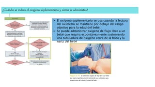 ¿Cuándo se indica el oxígeno suplementario y cómo se administra?
 El oxígeno suplementario se usa cuando la lectura
del oxímetro se mantiene por debajo del rango
objetivo para la edad del bebé.
 Se puede administrar oxígeno de flujo libre a un
bebé que respira espontáneamente sosteniendo
una tubuladura de oxígeno cerca de la boca y la
nariz del bebé
 
