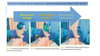 Cuales son los distintos tipos de dispositivos de reanimación utilizados para ventilar a recién nacidos?
 