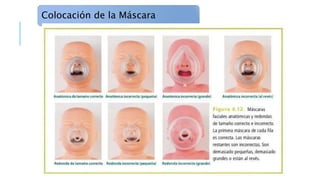 Colocación de la Máscara
 