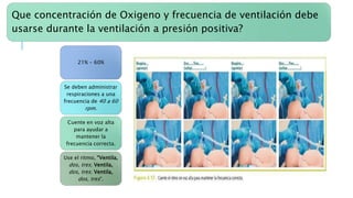 Que concentración de Oxigeno y frecuencia de ventilación debe
usarse durante la ventilación a presión positiva?
21% - 60%
Se deben administrar
respiraciones a una
frecuencia de 40 a 60
rpm.
Cuente en voz alta
para ayudar a
mantener la
frecuencia correcta.
Use el ritmo, “Ventila,
dos, tres; Ventila,
dos, tres; Ventila,
dos, tres”.
 