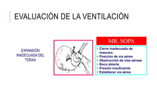 EXPANSIÓN
INADECUADA DEL
TÓRAX
• Cierre inadecuado de
mascara
• Posición de vía aérea
• Obstrucción de vías aéreas
• Boca abierta
• Presión insuficiente
• Establecer vía aérea
MR. SOPA
EVALUACIÓN DE LA VENTILACIÓN
 