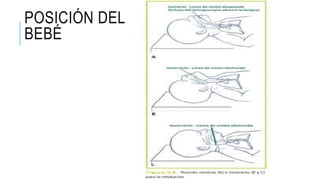 POSICIÓN DEL
BEBÉ
 