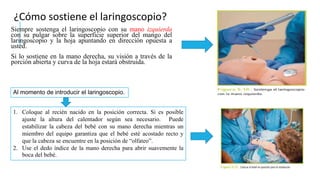 ¿Cómo sostiene el laringoscopio?
Siempre sostenga el laringoscopio con su mano izquierda
con su pulgar sobre la superficie superior del mango del
laringoscopio y la hoja apuntando en dirección opuesta a
usted.
Si lo sostiene en la mano derecha, su visión a través de la
porción abierta y curva de la hoja estará obstruida.
1. Coloque al recién nacido en la posición correcta. Si es posible
ajuste la altura del calentador según sea necesario. Puede
estabilizar la cabeza del bebé con su mano derecha mientras un
miembro del equipo garantiza que el bebé esté acostado recto y
que la cabeza se encuentre en la posición de “olfateo”.
2. Use el dedo índice de la mano derecha para abrir suavemente la
boca del bebé.
Al momento de introducir el laringoscopio.
 