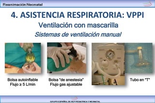 Sistemas de ventilación manual
Ventilación con mascarilla
Bolsa autoinflable
Flujo ≥ 5 L/min
Bolsa “de anestesia”
Flujo gas ajustable
Tubo en “T”
4. ASISTENCIA RESPIRATORIA: VPPI
 