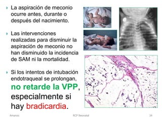 RCP Neonatal