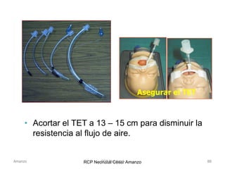 RCP Neonatal