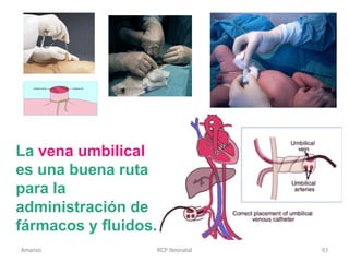 RCP Neonatal