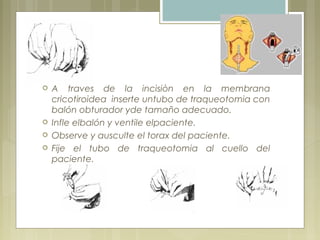  A traves de la incisiòn en la membrana
cricotiroidea inserte untubo de traqueotomia con
balón obturador yde tamaño adecuado.
 Infle elbalón y ventile elpaciente.
 Observe y ausculte el torax del paciente.
 Fije el tubo de traqueotomia al cuello del
paciente.
 