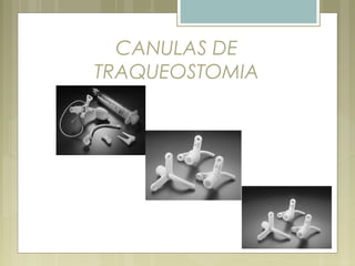 CANULAS DE
TRAQUEOSTOMIA
 