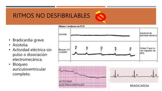 RITMOS NO DESFIBRILABLES
• Bradicardia grave.
• Asistolia
• Actividad eléctrica sin
pulso o disociación
electromecánica.
• Bloqueo
auriculoventricular
completo.
BRADICARDIA
 