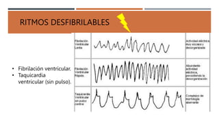 RITMOS DESFIBRILABLES
• Fibrilación ventricular.
• Taquicardia
ventricular (sin pulso).
 
