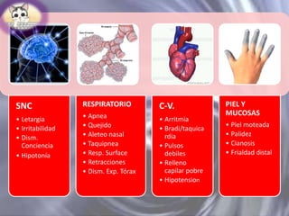SNC

RESPIRATORIO

C-V.

• Letargia
• Irritabilidad
• Dism.
Conciencia
• Hipotonía

• Apnea
• Quejido
• Aleteo nasal
• Taquipnea
• Resp. Surface
• Retracciones
• Dism. Exp. Tórax

• Arritmia
• Bradi/taquica
rdia
• Pulsos
debiles
• Relleno
capilar pobre
• Hipotension

PIEL Y
MUCOSAS
• Piel moteada
• Palidez
• Cianosis
• Frialdad distal

 