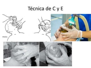 Técnica de C y E

 