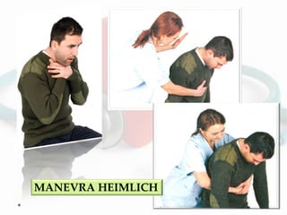 MANEVRA HEIMLICH
 