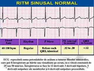 ECG reprezintă suma potenţialelor de acţiune a tuturor fibrelor miocardice,
care pot fi înregistrate pe hârtie sau vizualizate pe ecran, cu o viteză constantă de
25 sau 50 mm/sec. Înregistrarea se face în 12 derivaţii: 3 derivaţii bipolare, 3
derivaţii unipolare ale membrelor şi 6 derivaţii unipolare precordiale.
 