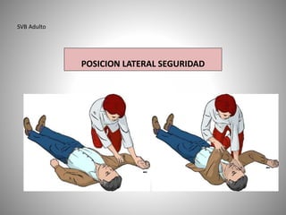 SVB Adulto
POSICION LATERAL SEGURIDAD
 