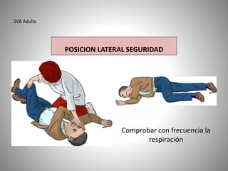 SVB Adulto
POSICION LATERAL SEGURIDAD
Comprobar con frecuencia la
respiración
 