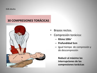 SVB Adulto
30 COMPRESIONES TORÁCICAS
• Brazos rectos.
• Compresión torácica:
– Ritmo 100x’
– Profundidad 5cm
– Igual tiempo de compresión y
de descompresión
Reducir al máximo las
interrupciones de las
compresiones torácicas
 