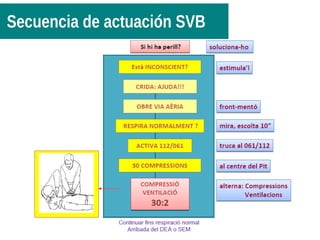 Secuencia de actuación SVB
 