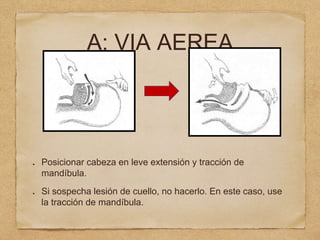 A: VIA AEREA
Posicionar cabeza en leve extensión y tracción de
mandíbula.
Si sospecha lesión de cuello, no hacerlo. En este caso, use
la tracción de mandíbula.
 