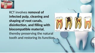 Comprehensive Overview of Root Canal Treatment: Procedure, Indications ...