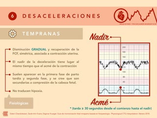 R Ctg RCTG obstetriciaaaaaaaaaaaaaaaaaaaaaaaaa | PDF
