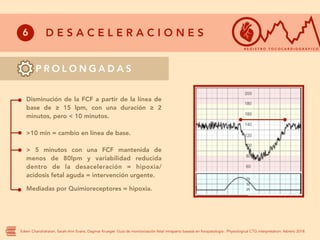 R Ctg RCTG obstetriciaaaaaaaaaaaaaaaaaaaaaaaaa | PDF