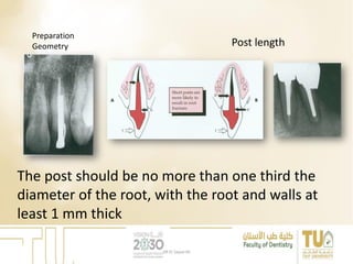Preparation
Geometry Post length
The post should be no more than one third the
diameter of the root, with the root and walls at
least 1 mm thick
DR EL Sayed Ali
 