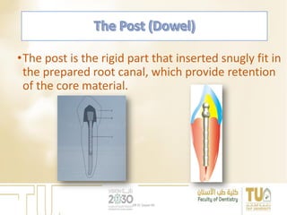 •The post is the rigid part that inserted snugly fit in
the prepared root canal, which provide retention
of the core material.
DR EL Sayed Ali
 