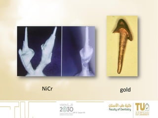 goldNiCr
DR EL Sayed Ali
 