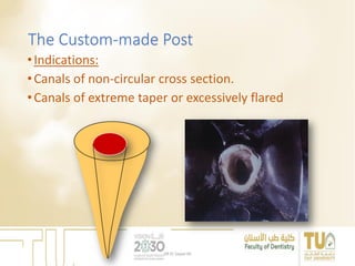 The Custom-made Post
•Indications:
•Canals of non-circular cross section.
•Canals of extreme taper or excessively flared
DR EL Sayed Ali
 