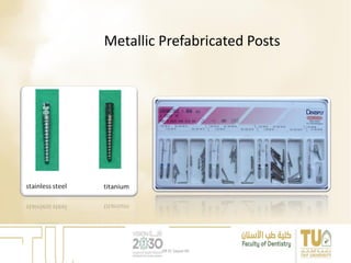 Metallic Prefabricated Posts
DR EL Sayed Ali
 
