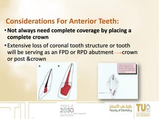 Considerations For Anterior Teeth:
•Not always need complete coverage by placing a
complete crown
•Extensive loss of coronal tooth structure or tooth
will be serving as an FPD or RPD abutment crown
or post &crown
DR EL Sayed Ali
 