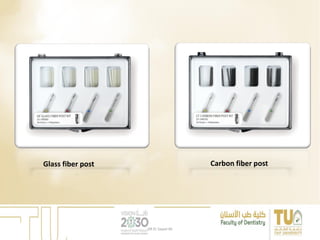 Glass fiber post Carbon fiber post
DR EL Sayed Ali
 