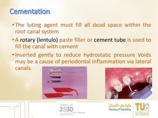 •The luting agent must fill all dead space within the
root canal system
•A rotary (lentulo) paste filler or cement tube is used to
fill the canal with cement
•Inserted gently to reduce hydrostatic pressure Voids
may be a cause of periodontal inflammation via lateral
canals.
DR EL Sayed Ali
 