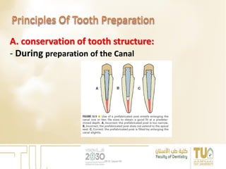 A. conservation of tooth structure:
- During preparation of the Canal
DR EL Sayed Ali
 
