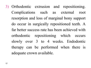 3) Orthodontic extrusion and repositioning.
Complications such as external root
resorption and loss of marginal bony support
do occur in surgically repositioned teeth. A
far better success rate has been achieved with
orthodontic repositioning which occurs
slowly over 3 to 4 weeks. Endodontic
therapy can be performed when there is
adequate crown available.
17
 