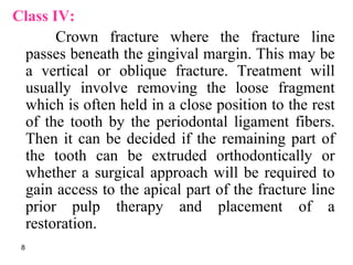 Class IV:
Crown fracture where the fracture line
passes beneath the gingival margin. This may be
a vertical or oblique fracture. Treatment will
usually involve removing the loose fragment
which is often held in a close position to the rest
of the tooth by the periodontal ligament fibers.
Then it can be decided if the remaining part of
the tooth can be extruded orthodontically or
whether a surgical approach will be required to
gain access to the apical part of the fracture line
prior pulp therapy and placement of a
restoration.
8
 